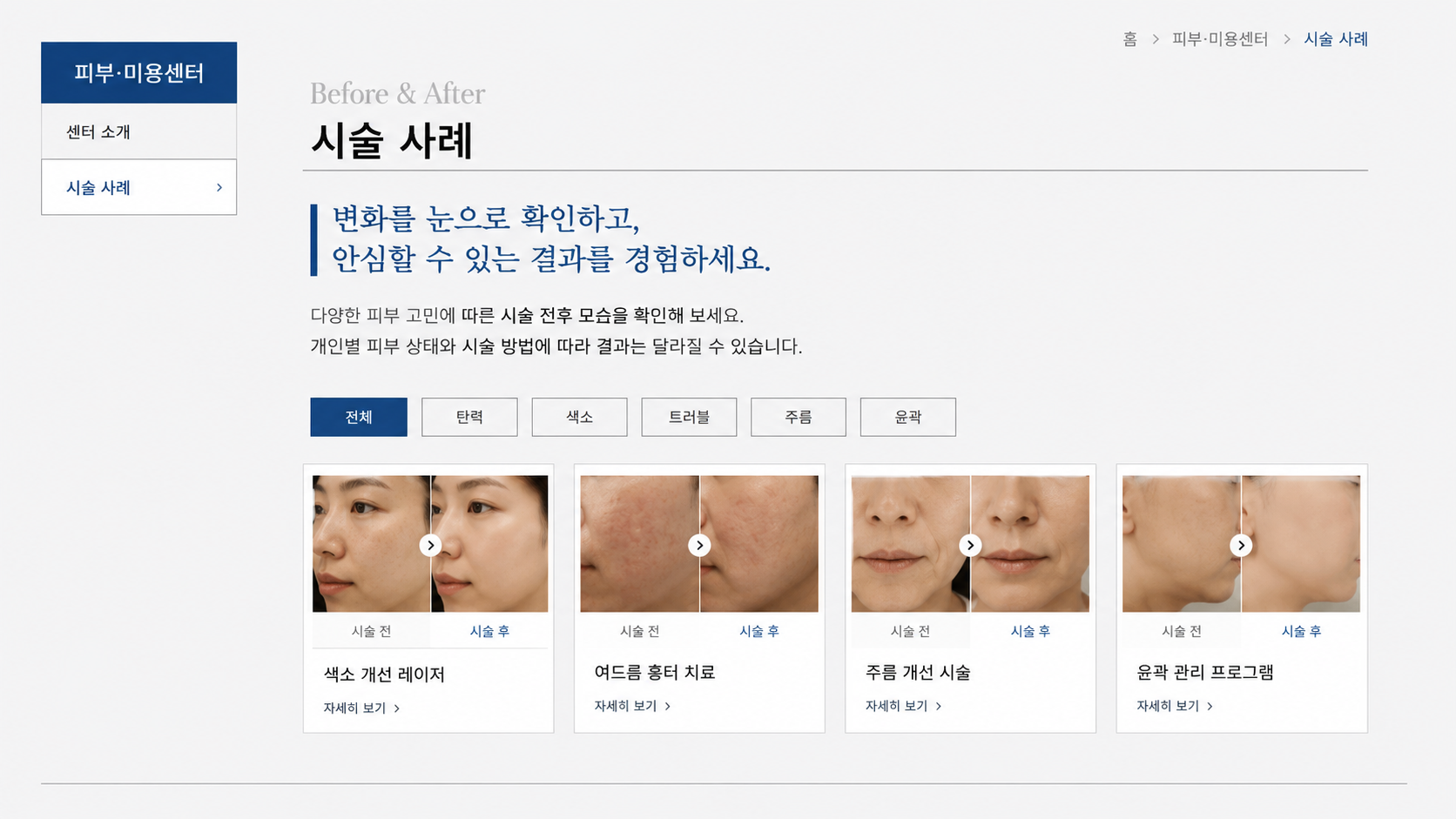 일반 병원 홈페이지 Before